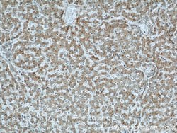 CMTM8 Rabbit anti-Human, Mouse, Rat, Polyclonal, Proteintech 150 &mu;L | Buy Online | Proteintech Group Inc | Fisher Scientific