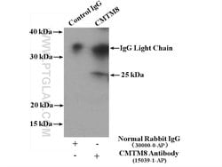 CMTM8 Rabbit anti-Human, Mouse, Rat, Polyclonal, Proteintech 150 &mu;L | Buy Online | Proteintech Group Inc | Fisher Scientific