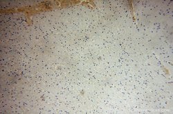 APLP2 Rabbit anti-Human, Mouse, Rat, Polyclonal, Proteintech:Antibodies:Primary