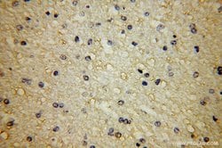 APLP2 Rabbit anti-Human, Mouse, Rat, Polyclonal, Proteintech:Antibodies:Primary
