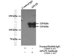 APLP2 Rabbit anti-Human, Mouse, Rat, Polyclonal, Proteintech:Antibodies:Primary
