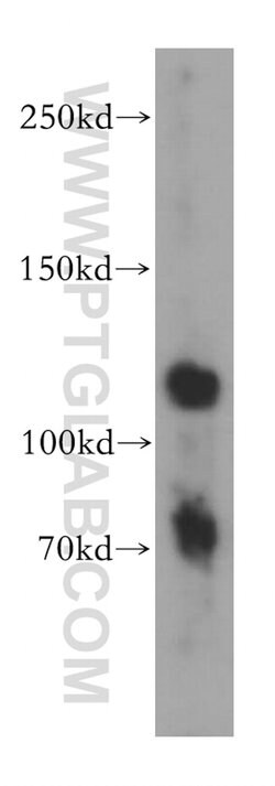 APLP2 Rabbit anti-Human, Mouse, Rat, Polyclonal, Proteintech:Antibodies:Primary