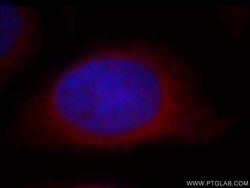 POMP Rabbit anti-Human, Mouse, Rat, Polyclonal, Proteintech 150 &mu;L;