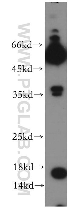 POMP Rabbit anti-Human, Mouse, Rat, Polyclonal, Proteintech 150 &mu;L;