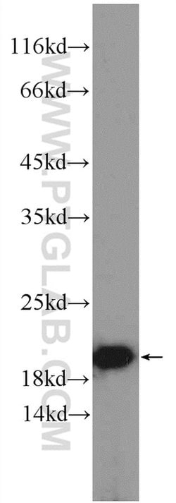 POMP Rabbit anti-Human, Mouse, Rat, Polyclonal, Proteintech 150 &mu;L;