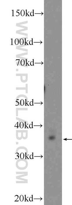 Thymidylate synthase Rabbit anti-Human, Mouse, Rat, Polyclonal, Proteintech