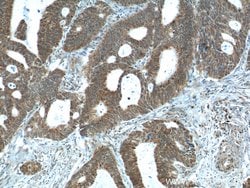 NUPR1 Rabbit anti-Human, Polyclonal, Proteintech 150 &mu;L; Unconjugated:Antibodies,