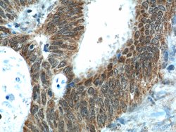 NUPR1 Rabbit anti-Human, Polyclonal, Proteintech 150 &mu;L; Unconjugated:Antibodies,