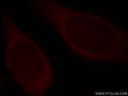 HPRT1 Rabbit anti-Human, Mouse, Rat, Polyclonal, Proteintech:Anticuerpos:Anticuerpos
