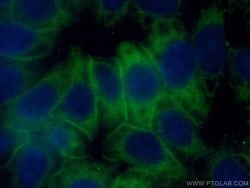 HPRT1 Rabbit anti-Human, Mouse, Rat, Polyclonal, Proteintech:Anticuerpos:Anticuerpos