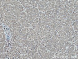 HPRT1 Rabbit anti-Human, Mouse, Rat, Polyclonal, Proteintech:Anticuerpos:Anticuerpos