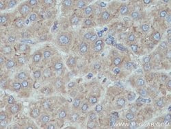 HPRT1 Rabbit anti-Human, Mouse, Rat, Polyclonal, Proteintech:Anticuerpos:Anticuerpos