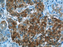 HPRT1 Rabbit anti-Human, Mouse, Rat, Polyclonal, Proteintech:Anticuerpos:Anticuerpos