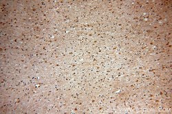 HPRT1 Rabbit anti-Human, Mouse, Rat, Polyclonal, Proteintech:Anticuerpos:Anticuerpos