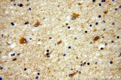HPRT1 Rabbit anti-Human, Mouse, Rat, Polyclonal, Proteintech:Anticuerpos:Anticuerpos