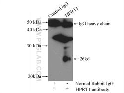 HPRT1 Rabbit anti-Human, Mouse, Rat, Polyclonal, Proteintech:Anticuerpos:Anticuerpos