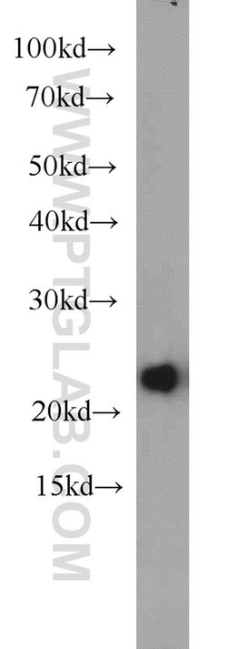 HPRT1 Rabbit anti-Human, Mouse, Rat, Polyclonal, Proteintech:Anticuerpos:Anticuerpos