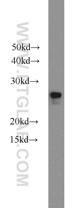 HPRT1 Rabbit anti-Human, Mouse, Rat, Polyclonal, Proteintech