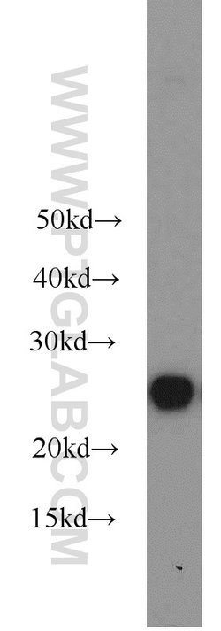 HPRT1 Rabbit anti-Human, Mouse, Rat, Polyclonal, Proteintech:Anticuerpos:Anticuerpos