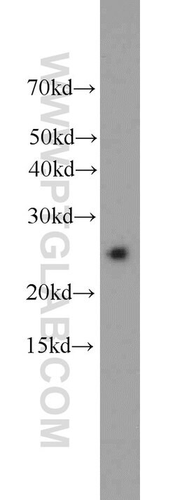 HPRT1 Rabbit anti-Human, Mouse, Rat, Polyclonal, Proteintech:Anticuerpos:Anticuerpos