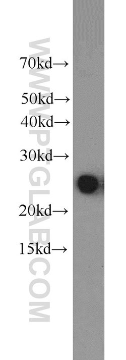 HPRT1 Rabbit anti-Human, Mouse, Rat, Polyclonal, Proteintech:Anticuerpos:Anticuerpos
