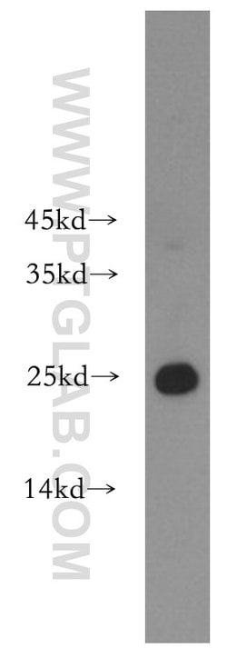 HPRT1 Rabbit anti-Human, Mouse, Rat, Polyclonal, Proteintech:Anticuerpos:Anticuerpos