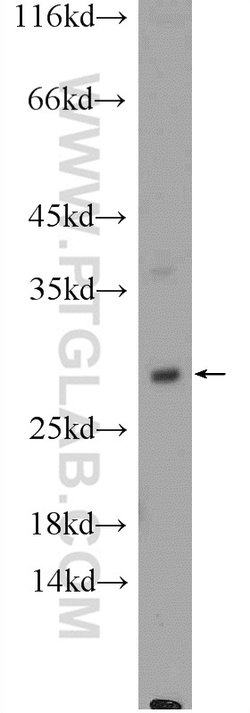 HPRT1 Rabbit anti-Human, Mouse, Rat, Polyclonal, Proteintech:Anticuerpos:Anticuerpos