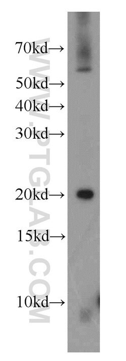 NDUFA8 Rabbit anti-Human, Mouse, Rat, Polyclonal, Proteintech 150 μL;
