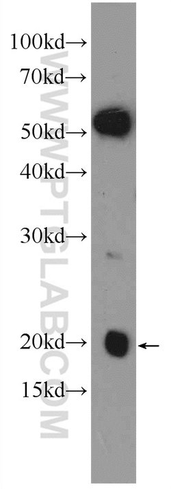NDUFA8 Rabbit anti-Human, Mouse, Rat, Polyclonal, Proteintech 150 μL;