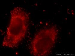 NDUFS3 Rabbit anti-Human, Mouse, Rat, Polyclonal, Proteintech 150 &mu;L;