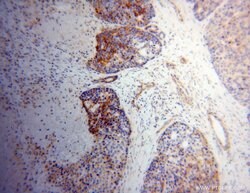NDUFS3 Rabbit anti-Human, Mouse, Rat, Polyclonal, Proteintech 150 &mu;L;