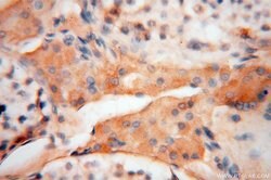 NDUFS3 Rabbit anti-Human, Mouse, Rat, Polyclonal, Proteintech 150 &mu;L;