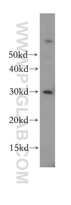 NDUFS3 Rabbit anti-Human, Mouse, Rat, Polyclonal, Proteintech 150 &mu;L;