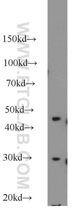 NDUFS3 Rabbit anti-Human, Mouse, Rat, Polyclonal, Proteintech 150 &mu;L;