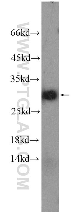 NDUFS3 Rabbit anti-Human, Mouse, Rat, Polyclonal, Proteintech 150 &mu;L;