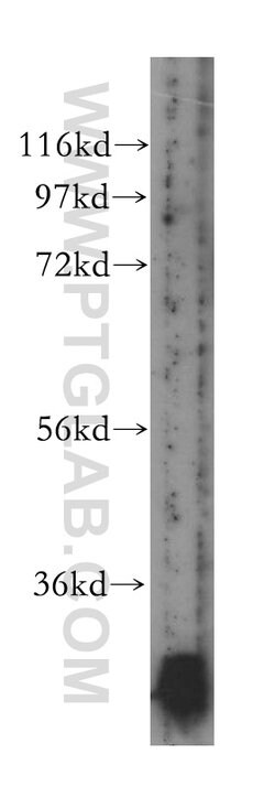 NDUFS3 Rabbit anti-Human, Mouse, Rat, Polyclonal, Proteintech 150 &mu;L;