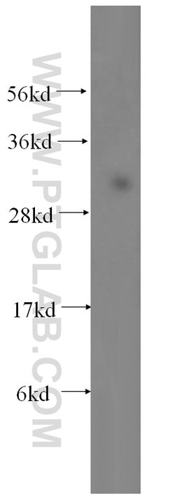 NDUFS3 Rabbit anti-Human, Mouse, Rat, Polyclonal, Proteintech 150 &mu;L;