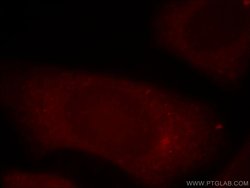 PI4K2B Rabbit anti-Human, Mouse, Rat, Polyclonal, Proteintech:Antibodies:Primary
