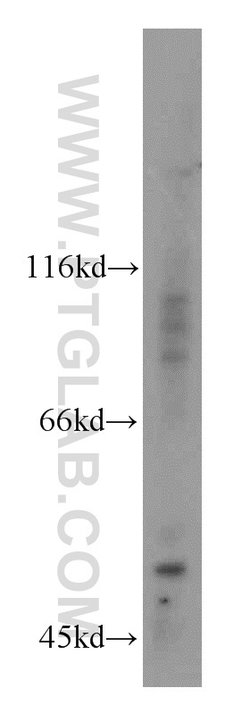 PI4K2B Rabbit anti-Human, Mouse, Rat, Polyclonal, Proteintech:Antibodies:Primary