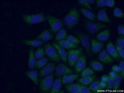 HPS1 Rabbit anti-Human, Polyclonal, Proteintech