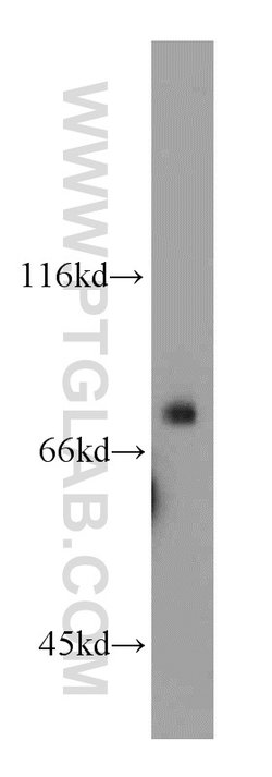 HPS1 Rabbit anti-Human, Polyclonal, Proteintech:Antikörper:Primärantikörper