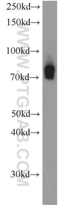 HPS1 Rabbit anti-Human, Polyclonal, Proteintech:Antikörper:Primärantikörper