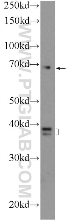 HPS1 Rabbit anti-Human, Polyclonal, Proteintech:Antikörper:Primärantikörper