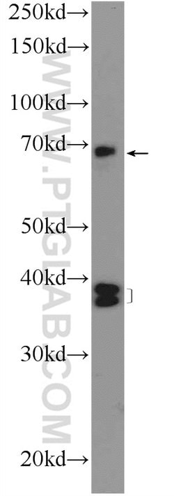 HPS1 Rabbit anti-Human, Polyclonal, Proteintech:Antikörper:Primärantikörper