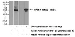 HPS1 Rabbit anti-Human, Polyclonal, Proteintech:Antikörper:Primärantikörper