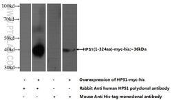 HPS1 Rabbit anti-Human, Polyclonal, Proteintech:Antikörper:Primärantikörper