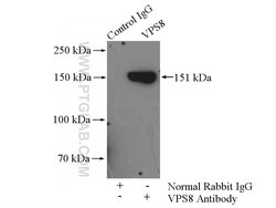 VPS8 Rabbit anti-Human, Mouse, Rat, Polyclonal, Proteintech 150 &mu;L | Buy Online | Proteintech Group Inc | Fisher Scientific