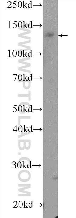 VPS8 Rabbit anti-Human, Mouse, Rat, Polyclonal, Proteintech 150 &mu;L | Buy Online | Proteintech Group Inc | Fisher Scientific