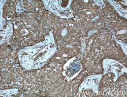 PDAP1 Rabbit anti-Human, Polyclonal, Proteintech 150 &mu;L; Unconjugated:Antibodies,