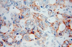 COQ7 Rabbit anti-Human, Mouse, Rat, Polyclonal, Proteintech 20 &mu;L; Unconjugated:Antibodies,